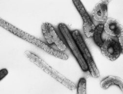 Antisipasi Penyebaran Virus Marburg, Indonesia Diingatkan Perkuat Sistem Deteksi Dini