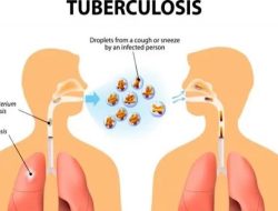 WHO Papar Laporan, Tuberkulosis Jadi Penyakit Menular dan Paling Mematikan di Dunia!