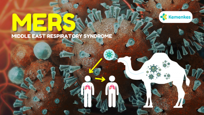9 Kasus Terkonfirmasi Positif Virus MERS-CoV di Arab Saudi, Jemaah Haji Diimbau Hindari Kontak Langsung dengan Unta