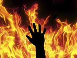 Tragis! Seorang Bocah SD Kritis Usai Dibakar 4 Temannya dengan Spirtus, Polisi Selidiki Motif