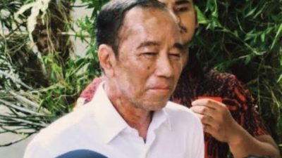 Dikaitkan dengan Penyakit yang Diidap Jokowi: Ini Beda SJS dan Alergi Kulit, Kenali Gejalanya