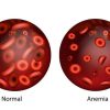 Padahal Diberi ASI Sampai 6 Bulan, Kenapa Anak Mengalami Anemia Defisiensi Besi?