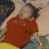 Bocah R Alami Infeksi Ascaris Lumbricoudes: Tubuhnya Dipenuhi Cacing, Menjalar Sampai ke Otak