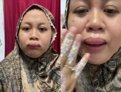 Viral! Bibir Bengkak 3 Jam Sebelum Akad, Pengantin Ini Tetap Gaspol Pakai Siger!