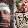 Eks Marinir RI Satria Kumbara Luka Parah Diserang Mortir dan Drone di Ukraina