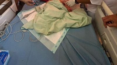 Ngeri! Balita di Bengkulu Muntahkan Cacing dari Mulut dan Hidung, Perut Penuh Gumpalan