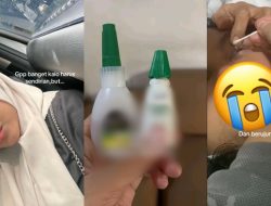 Video 7 Juta Views: Dikira Obat Mata, Lem Cair Masuk ke Mata hingga Harus ke RS