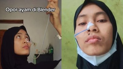 Viral! Gadis Tasikmalaya Idap Penyakit 1 Banding 100 Ribu, Makan Hanya Bisa Lewat Selang