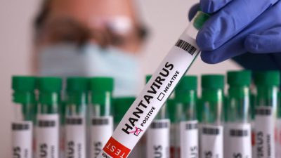 Waspada Teror Tikus! 4 Kasus Hantavirus Ditemukan di Jakarta, Kadinkes DKI Beri Peringatan Keras