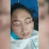 Tragis! Ogah Diajak Balikan, Perawat di Cirebon Dianiaya Dokter Spesialis di Ruang IGD