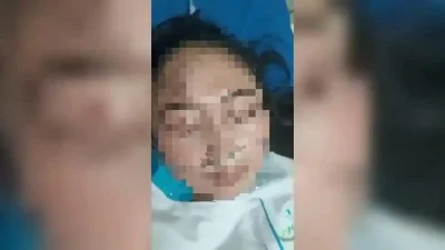 Tragis! Ogah Diajak Balikan, Perawat di Cirebon Dianiaya Dokter Spesialis di Ruang IGD